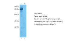 KCNN2 Rabbit anti-Human, Rat, Monkey, Polyclonal, Novus Biologicals 0.1
